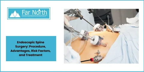How To Effectively Research a PPO Spine Surgeon